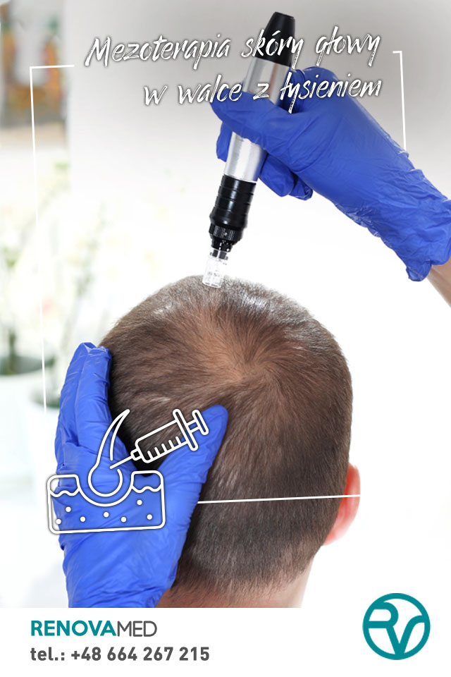 Terapia peptydowa sposób na wypadanie włosów